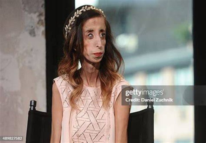 Lizzie Velasquez at AOL Studios in New York City. Lizzie Velasquez at AOL Studios in New York City.