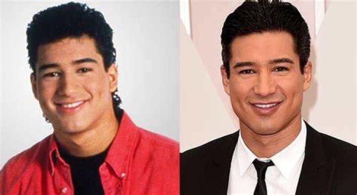 Mario Lopez surgery