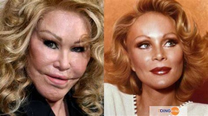 Pictures of Jocelyn Wildenstein (L), Lizzie Velasquez (C) and Michael Berryman (R). Pictures of Jocelyn Wildenstein (L), Lizzie Velasquez (C) and Michael Berryman (R).