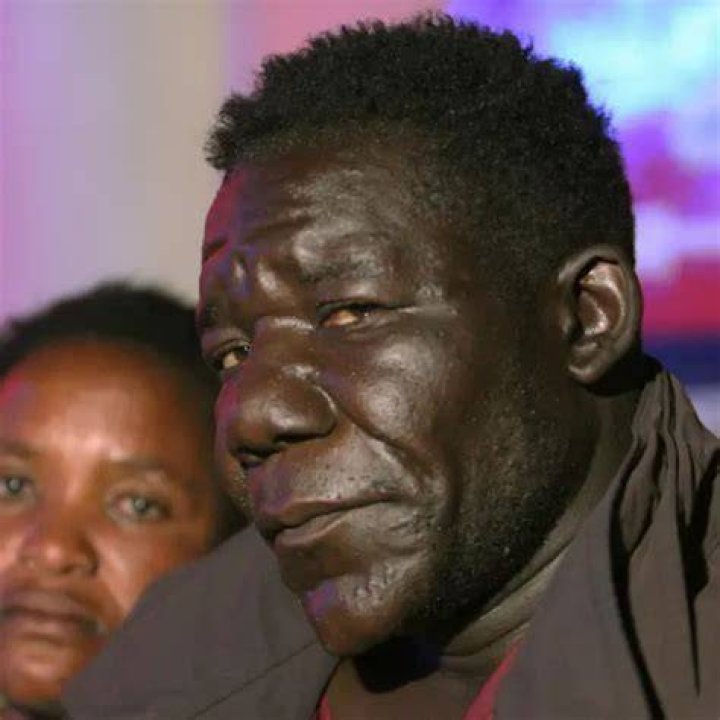 Williams Masvinu is recognised for his large nose and facial features. Williams Masvinu is recognised for his large nose and facial features.